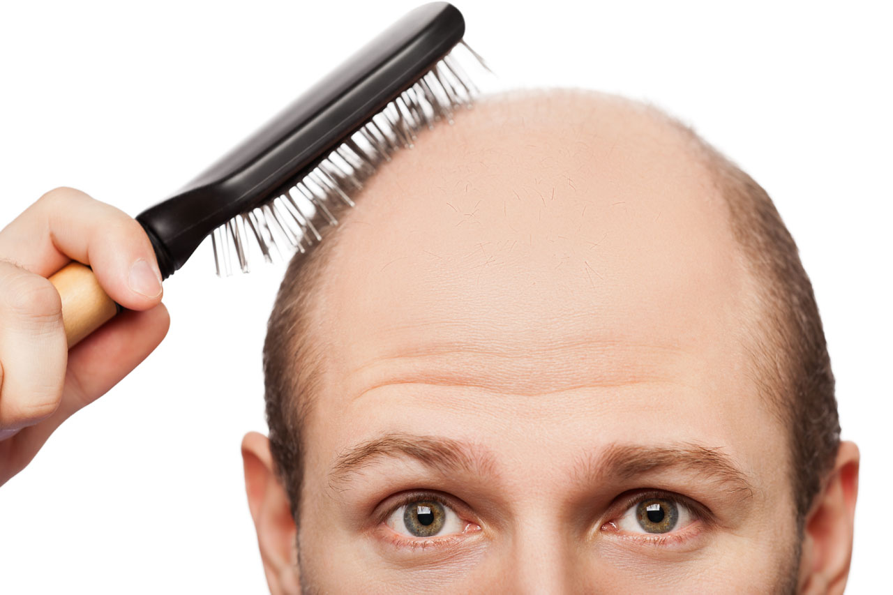 hairloss-brushinghair7